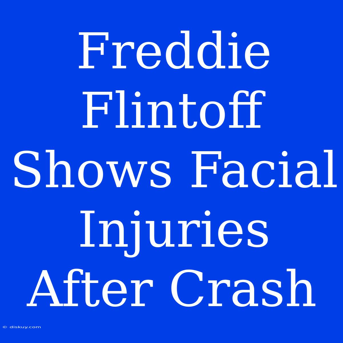 Freddie Flintoff Shows Facial Injuries After Crash