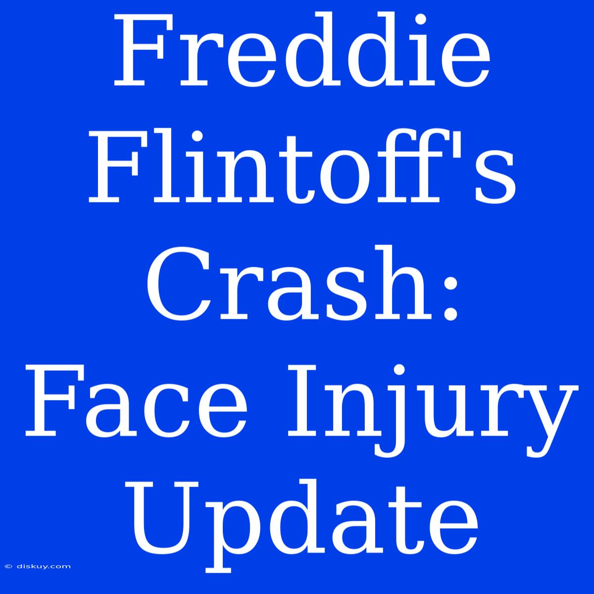 Freddie Flintoff's Crash: Face Injury Update