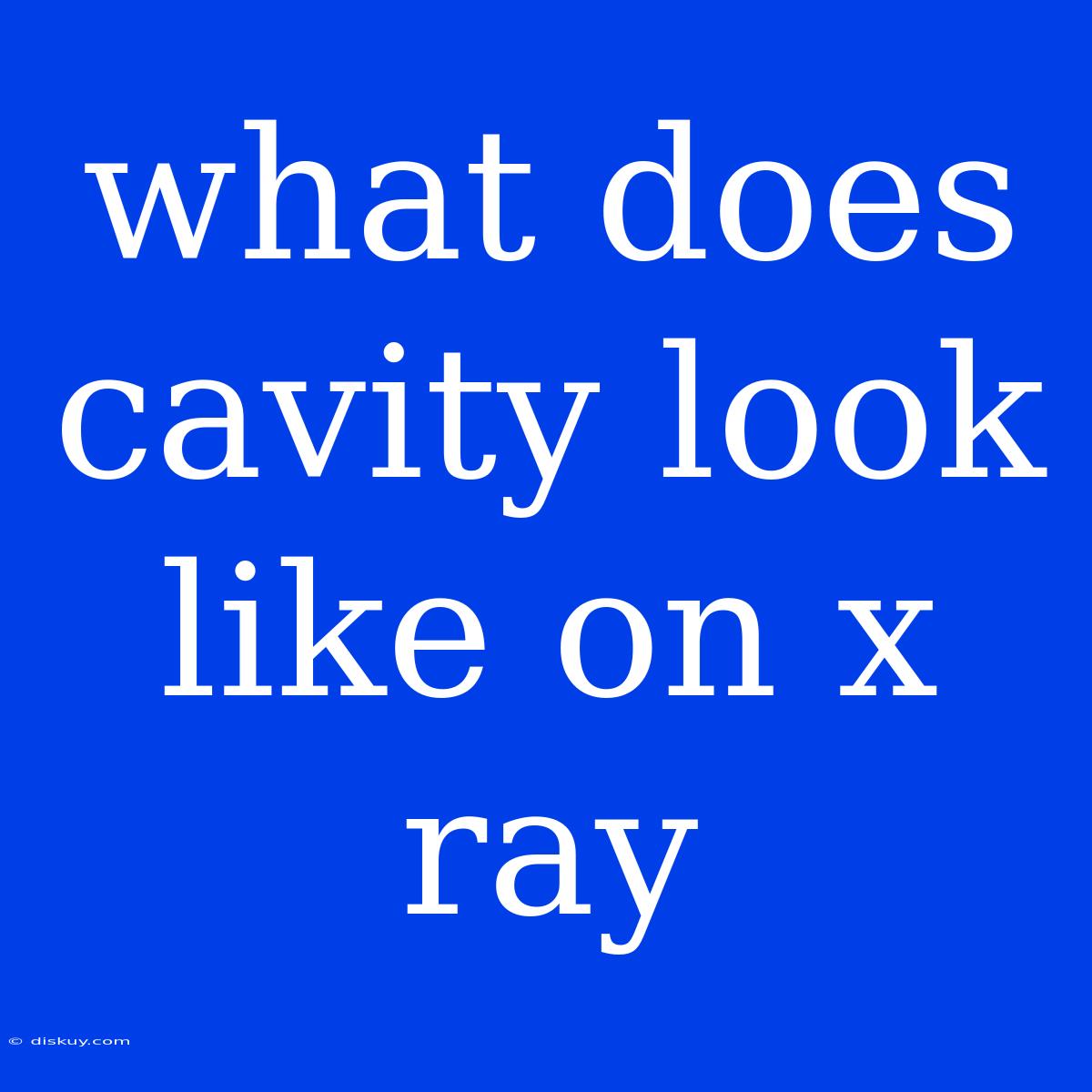 What Does Cavity Look Like On X Ray